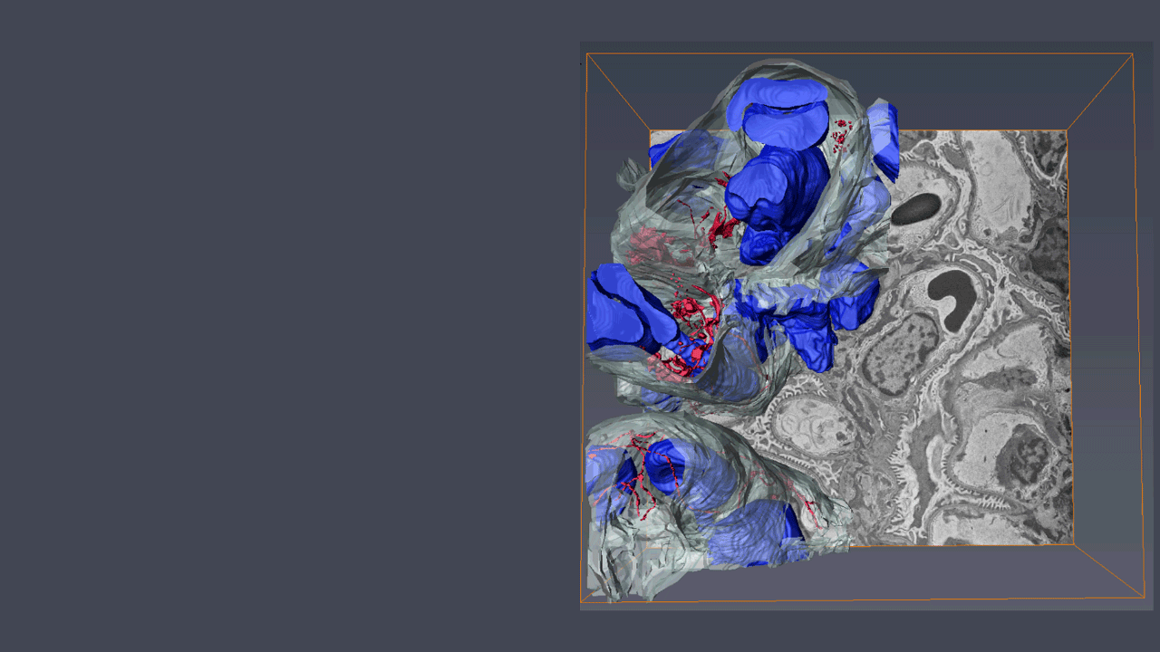 3D ultrastructure of the kidney glomerulus capillary and microfibrils imaged using SBF-SEM