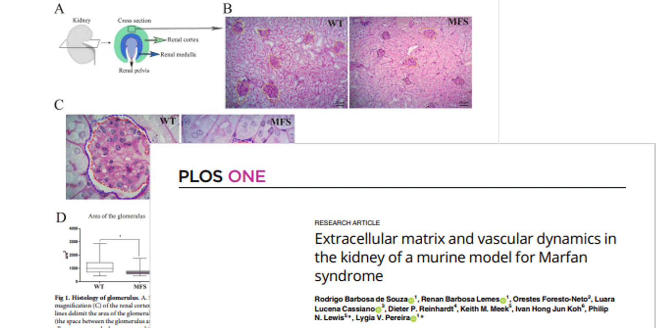 PLOS One article: Extracellular matrix and vascular dynamics in the kidney of a murine model for Marfan syndrome
