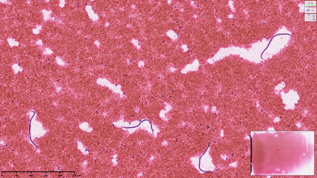 Dirofilaria immitis (dog heart worm) parasites, imaged in a blood smear from a canine using brightfield microscopy.