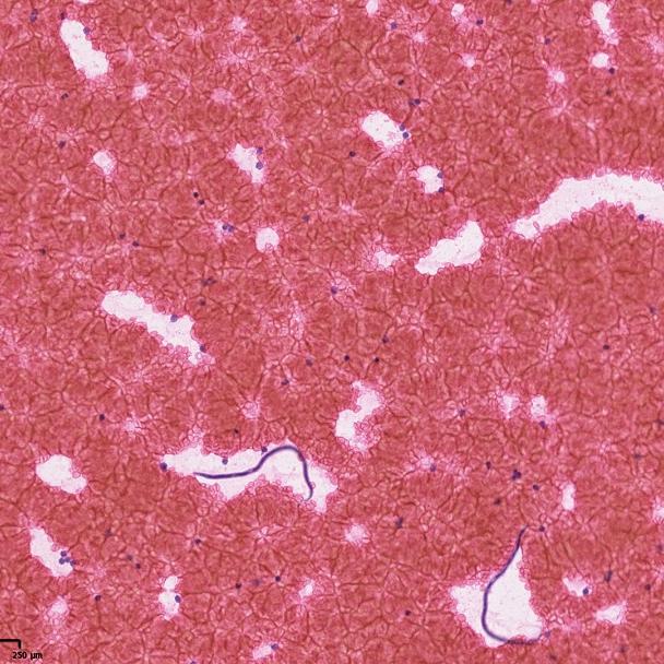 Dirofilaria immitis (dog heart worm) parasites, imaged in a blood smear from a canine using brightfield microscopy.