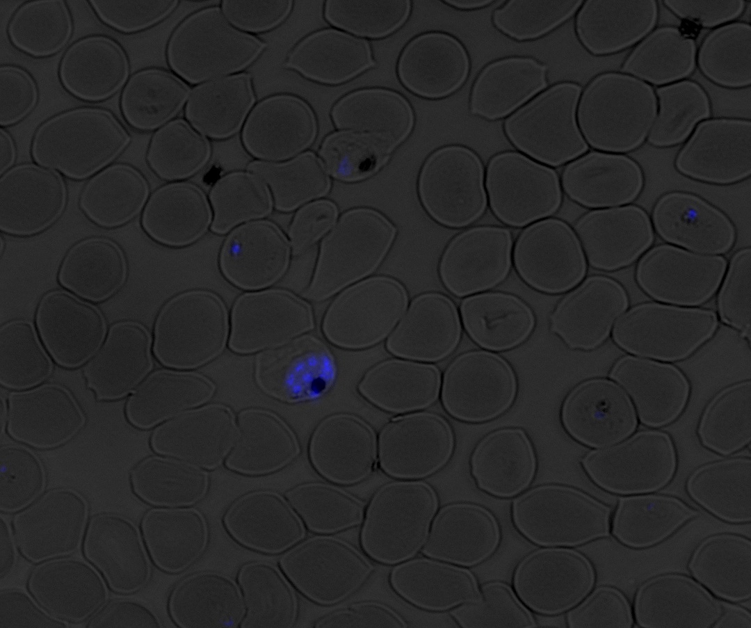 DAPI-labeled nuclei of the malaria parasite Plasmodium falciparum inside of human red blood cells imaged using fluorescence microscopy.