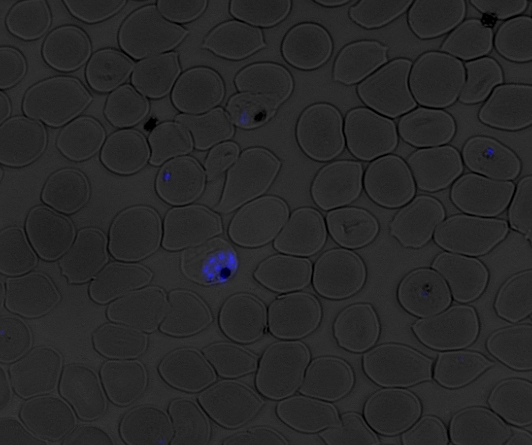 DAPI-labeled nuclei of the malaria parasite Plasmodium falciparum inside of human red blood cells imaged using fluorescence microscopy.