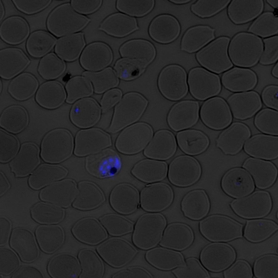 DAPI-labeled nuclei of the malaria parasite Plasmodium falciparum inside of human red blood cells imaged using fluorescence microscopy.