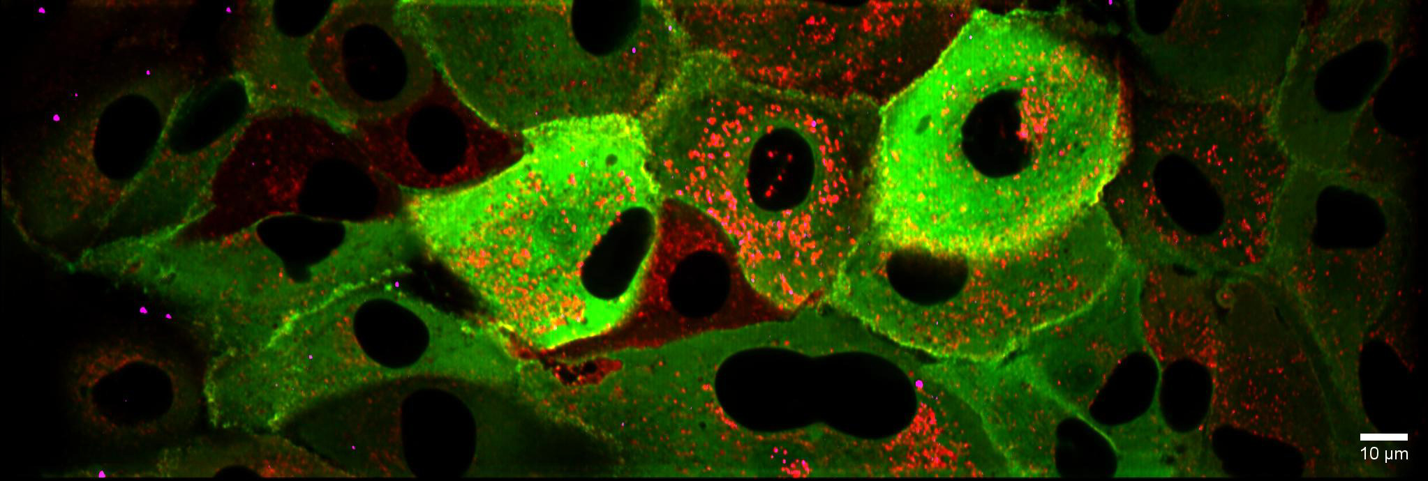 Understanding Influenza A Virus Entry Through Lattice Light Sheet