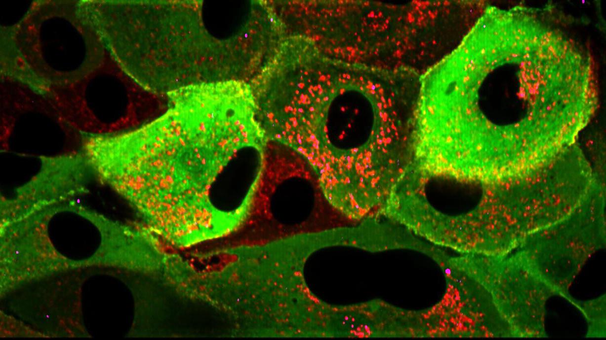 RPE cell monolayer getting infected with DiD-tagged IAV particles