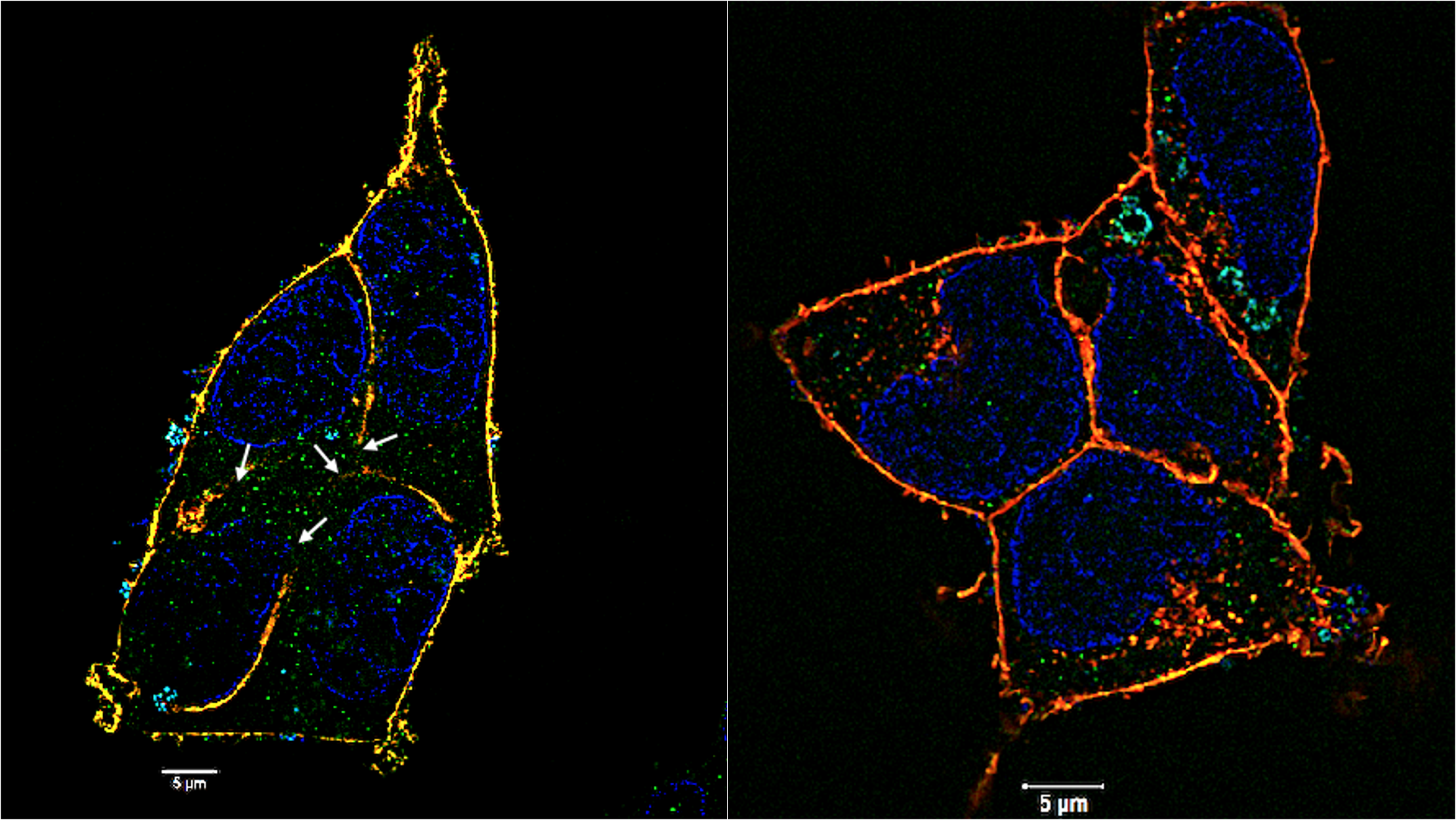 HEK 293-ACE2 cells (human embryonic kidney cells genetically modified to express ACE2, the receptor used by SARS-CoV-2 to enter host cells) infected with the virus.