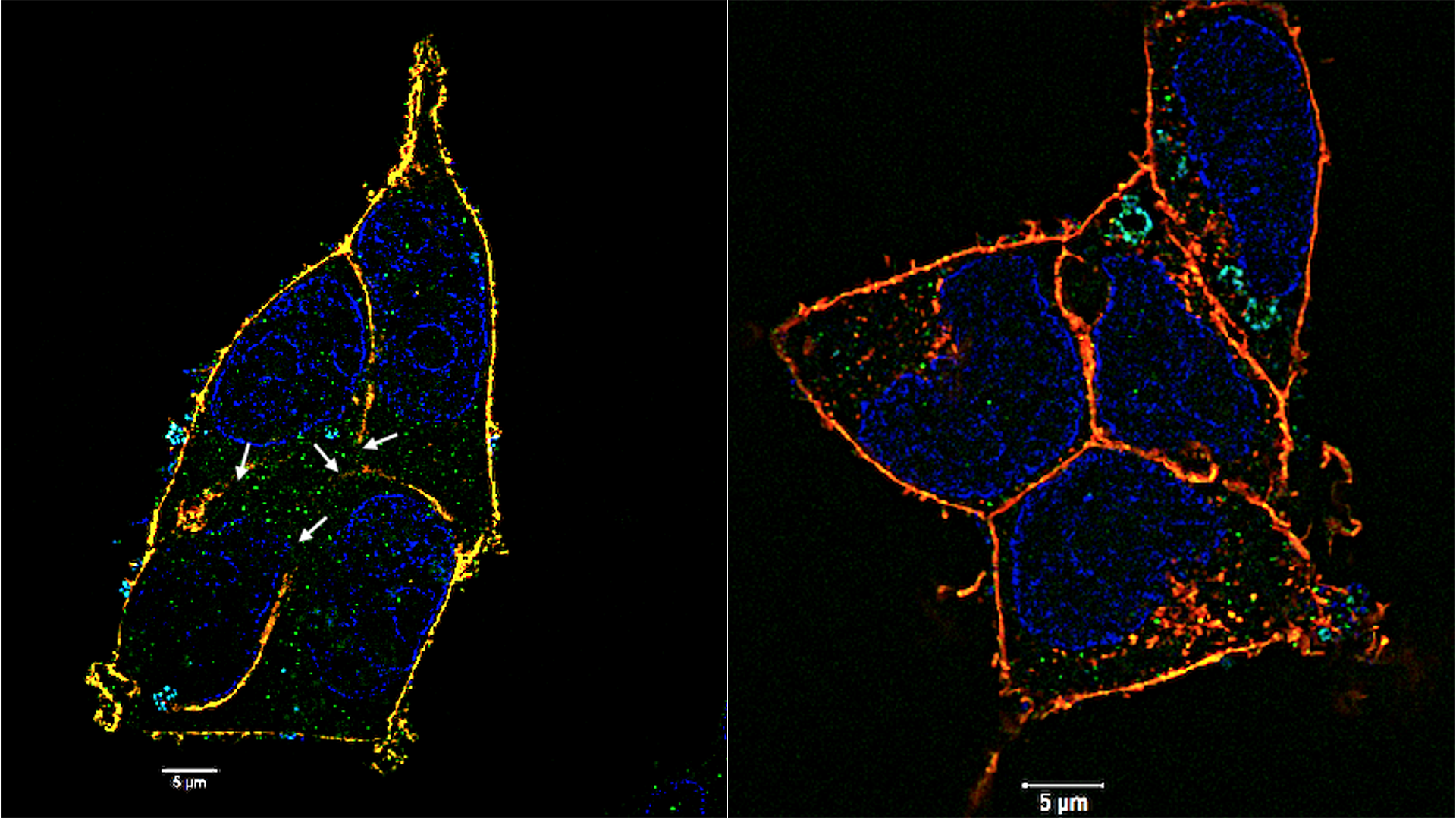 HEK 293-ACE2 cells (human embryonic kidney cells genetically modified to express ACE2, the receptor used by SARS-CoV-2 to enter host cells) infected with the virus.