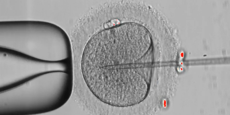 A microscopic view of an egg cell being injected with a needle, during IMSI procedure.