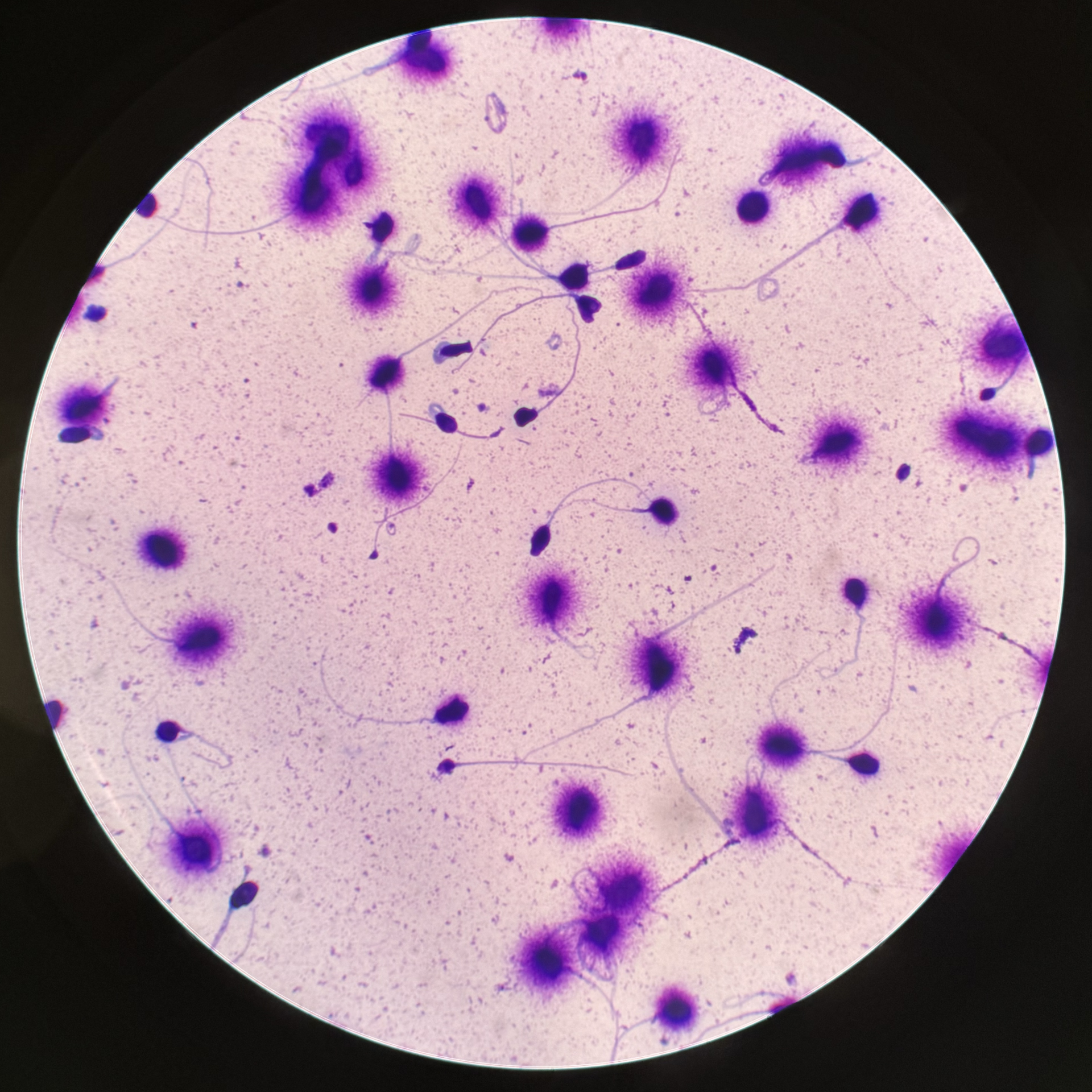 Microscopic view of stained sperm cells showing numerous purple sperm with visible tails scattered across a pale background.