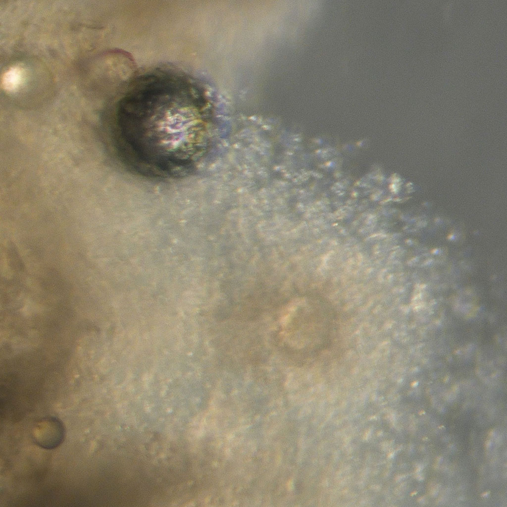Microscopic image of a human egg showing details of the surrounding cells.