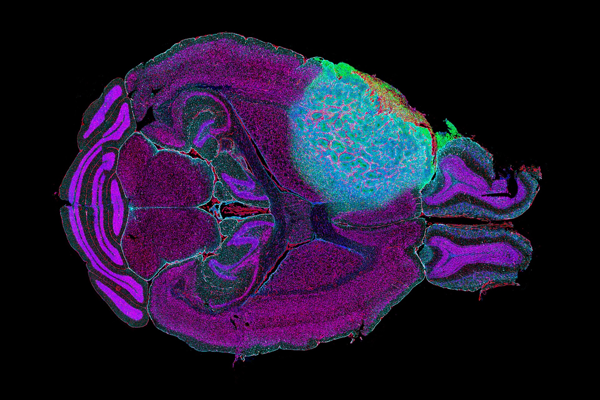 Hyper multiplexed spatial biology image of a mouse brain section bearing a high-grade glioblastoma consisting of 45 markers acquired with ZEISS Axioscan high-throughput digital scanner