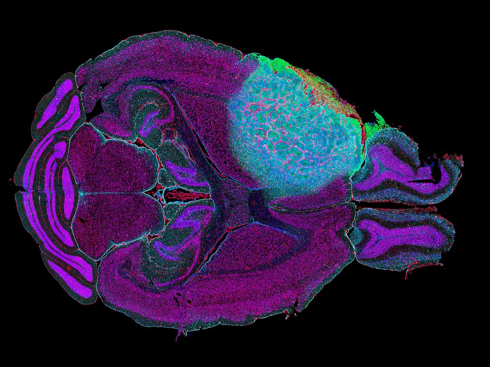 ZEISS spatial biology solutions enable detailed multiplex imaging to explore neural tissue architecture and biomarkers in neurology research.
