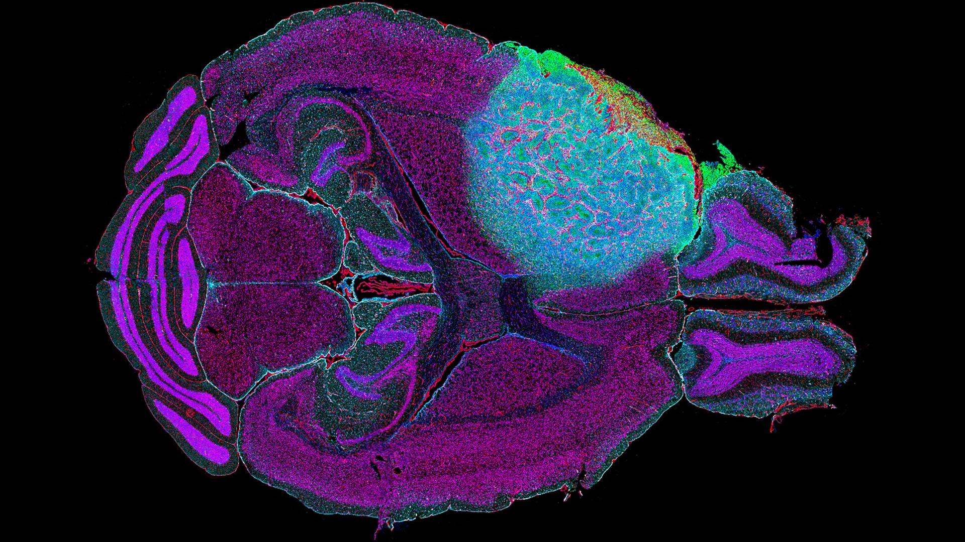 Hyper multiplexed spatial biology image of a mouse brain section bearing a high-grade glioblastoma consisting of 45 markers acquired with ZEISS Axioscan high-throughput digital scanner