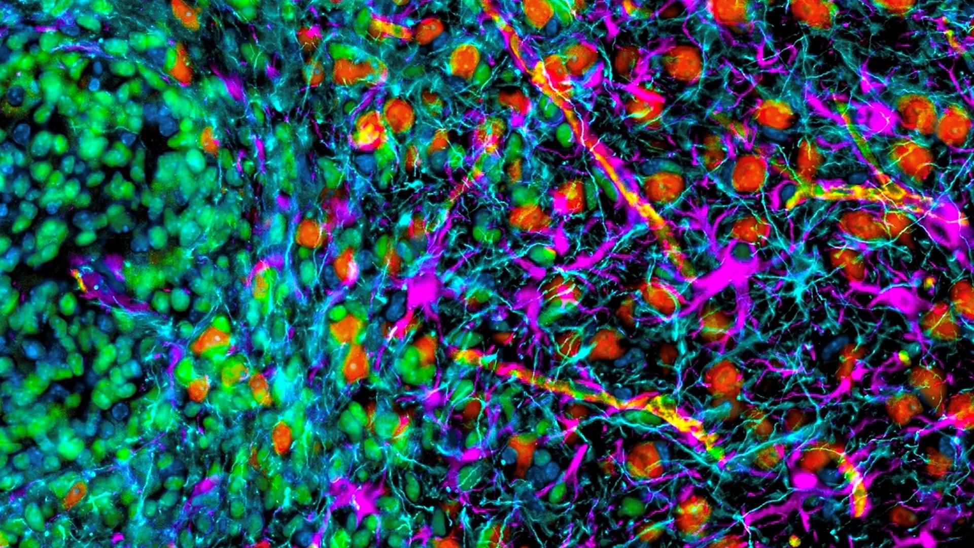 Hyper multiplexed (HIFI) image exploring the spatial biology of a mouse brain glioblastoma focused on the dynamic interface between the tumor and the surrounding brain.