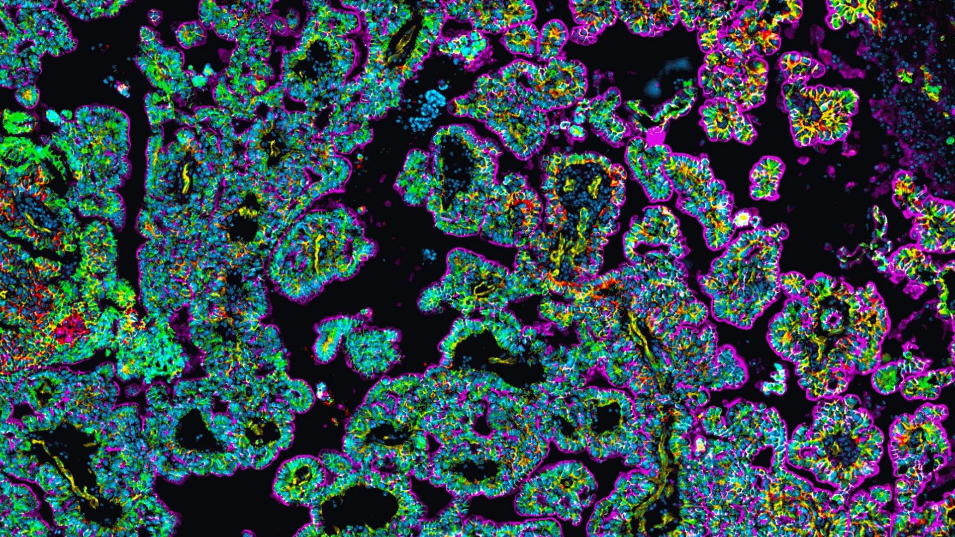 Hyperplexed immunofluorescence (HIFI) spatial biology of a mouse model of breast-to-brain metastasis