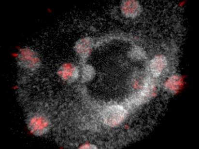 Arabidopsis thaliana structured illumination microscopy image