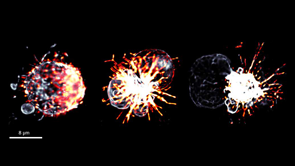 Microscopic images show cells with bright, branching structures extending outwards; a 4 μm scale bar is present in the lower left corner.