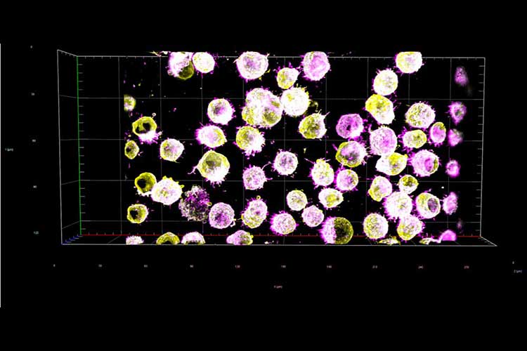A 3D microscopic image showing clusters of spherical cells highlighted in yellow and pink on a black background with grid lines.