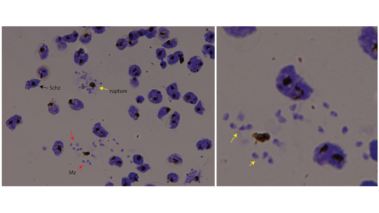 Giemsa stain of malaria parasites rupturing and invading red blood cells. Schz: Schizont – young malaria parasite.