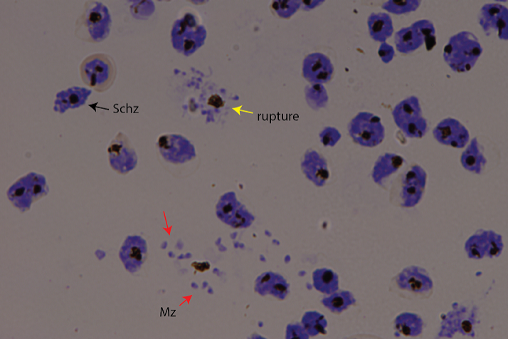 Giemsa stain of malaria parasites rupturing and invading red blood cells. Schz: Schizont – young malaria parasite.