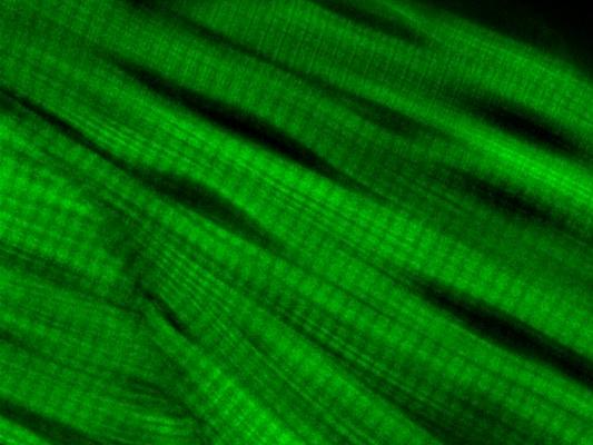 ZEISS Airyscan | Actin-stained Zebrafish