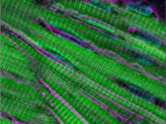 ZEISS Airyscan | Multicolor Zebrafish