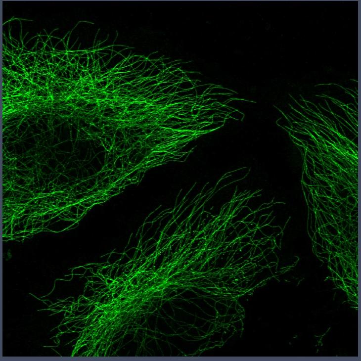 ZEISS Airyscan | Microtubules in NRK cells