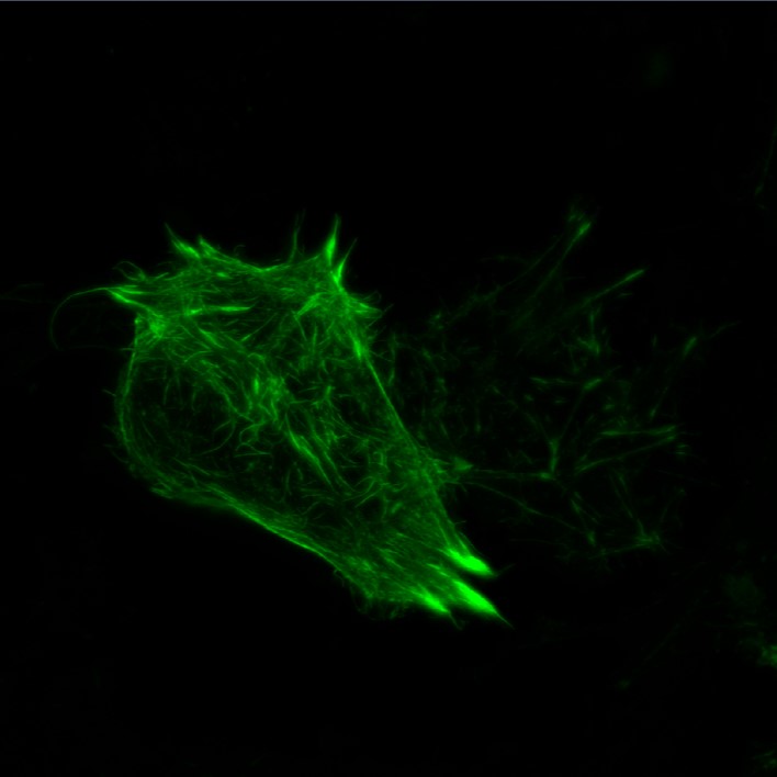 ZEISS Airyscan | Actin in U251 cells