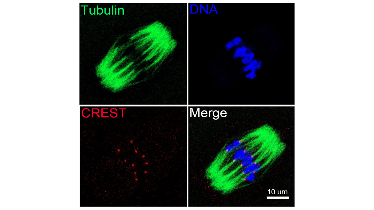 Spindle assembly and chromosome alignment in a mouse oocyte in metaphase stage