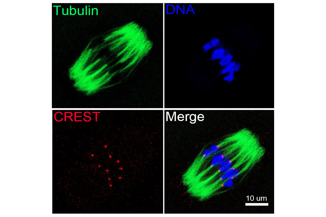 Spindle assembly and chromosome alignment in a mouse oocyte in metaphase stage