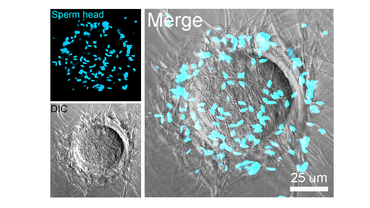 The binding of mouse sperm to the mouse egg