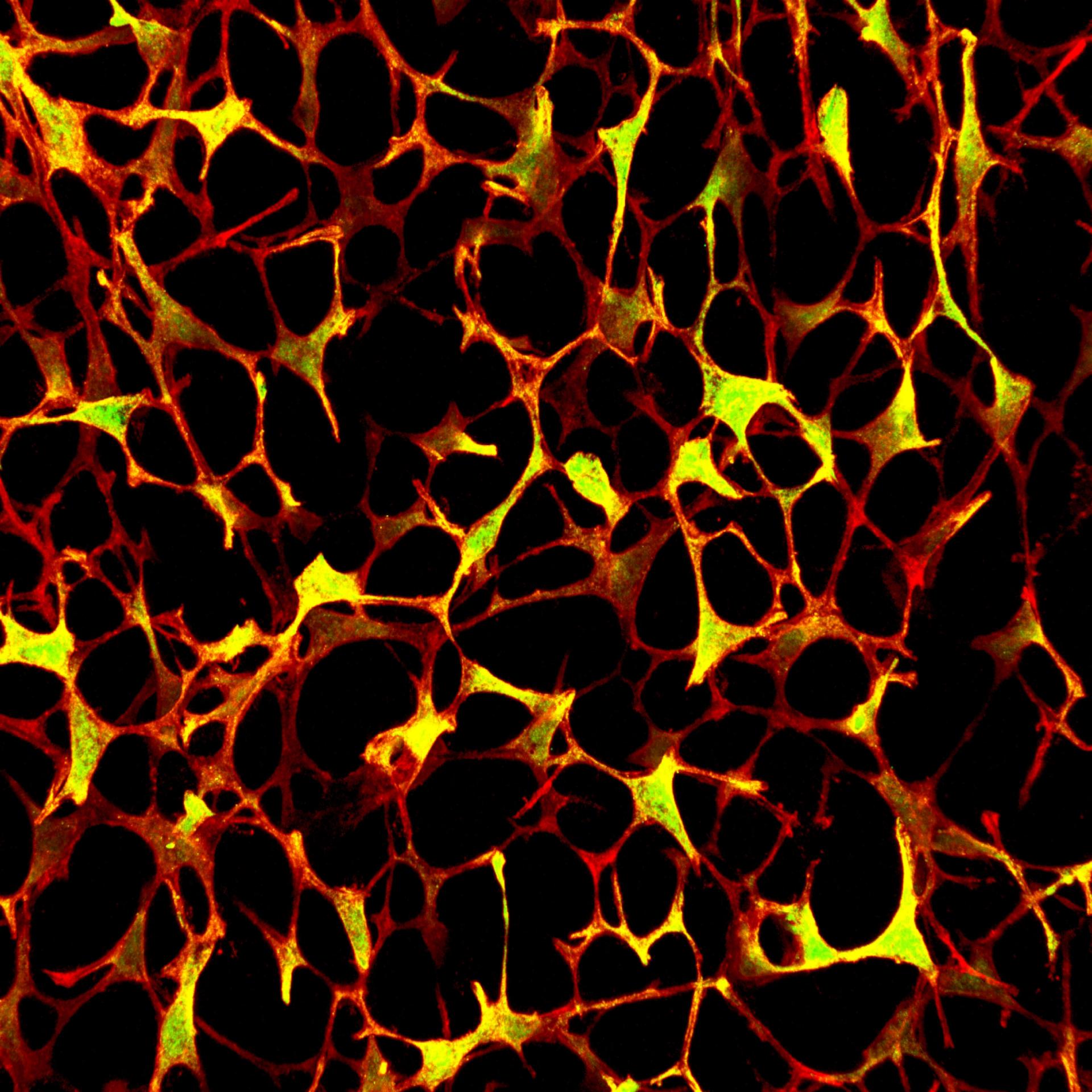 Microscopic image of porous, web-like structure with orange and yellow hues on a black background, resembling a network of interconnected cells or tissue fibers.