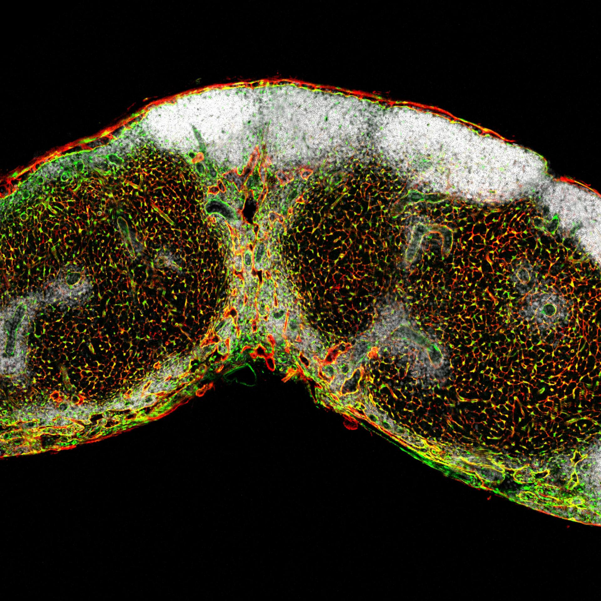 Microscopic image shows a fluorescently stained mouse lymph node with distinct colors highlighting various cellular structures.