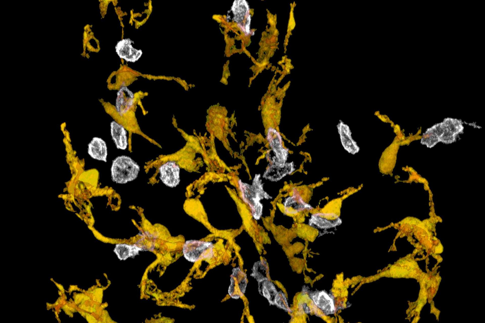 Microscopic image showing yellow and white structures on a black background, resembling nerve cells or neurons interconnected in a network-like pattern.