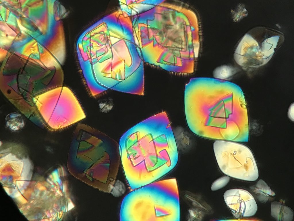 Uric acid crystals in urine sediment seen under polarized light microscopy with ZEISS Primostar