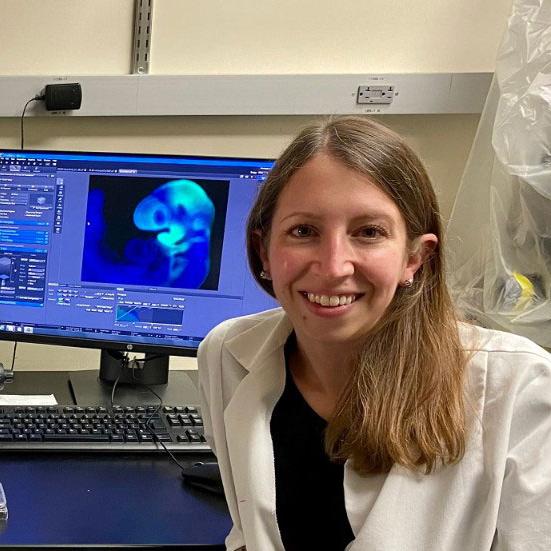 Dr. Katherine Fantauzzo, Assistant Professor in the Department of Craniofacial Biology at the University of Colorado Anschutz Medical Campus, USA