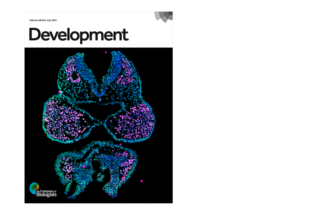 Dr. Brenna Dennison and Fantauzzo's recent work was published in Development. Their image of the cranial neural folds and first pharyngeal arches of a mouse embryo, acquired with a ZEISS Axio Observer 7 microscope with Apotome, was featured on the journal cover.