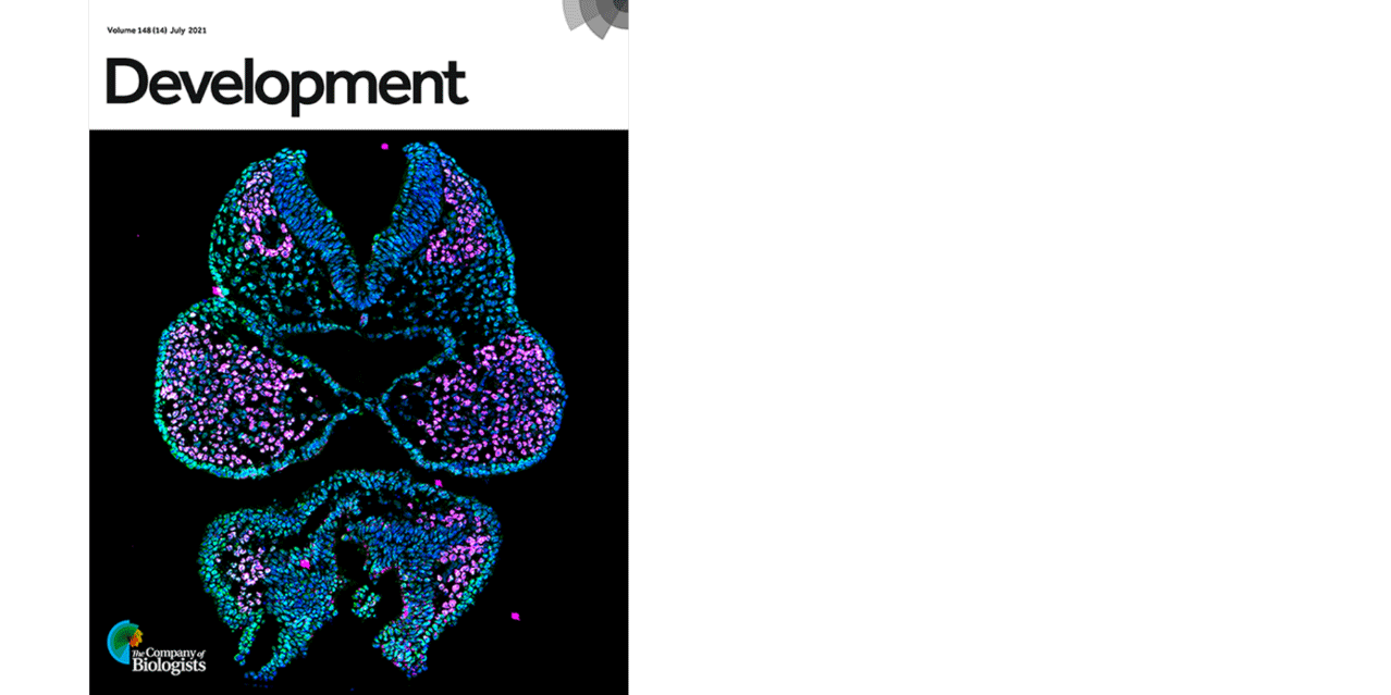 Dr. Brenna Dennison and Fantauzzo's recent work was published in Development. Their image of the cranial neural folds and first pharyngeal arches of a mouse embryo, acquired with a ZEISS Axio Observer 7 microscope with Apotome, was featured on the journal cover.