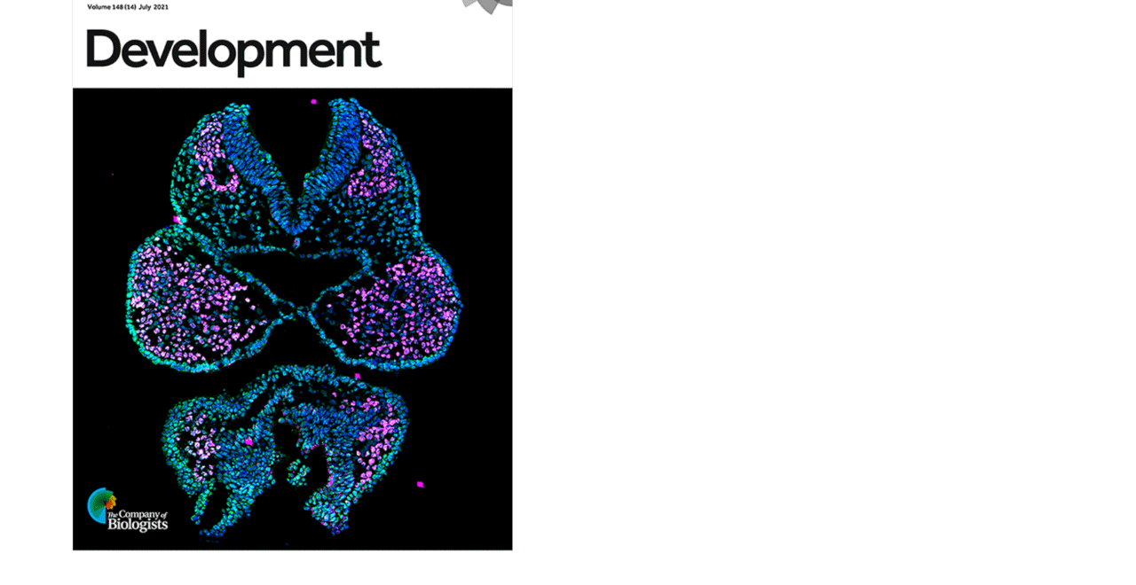 Dr. Brenna Dennison and Fantauzzo's recent work was published in Development. Their image of the cranial neural folds and first pharyngeal arches of a mouse embryo, acquired with a ZEISS Axio Observer 7 microscope with Apotome, was featured on the journal cover.