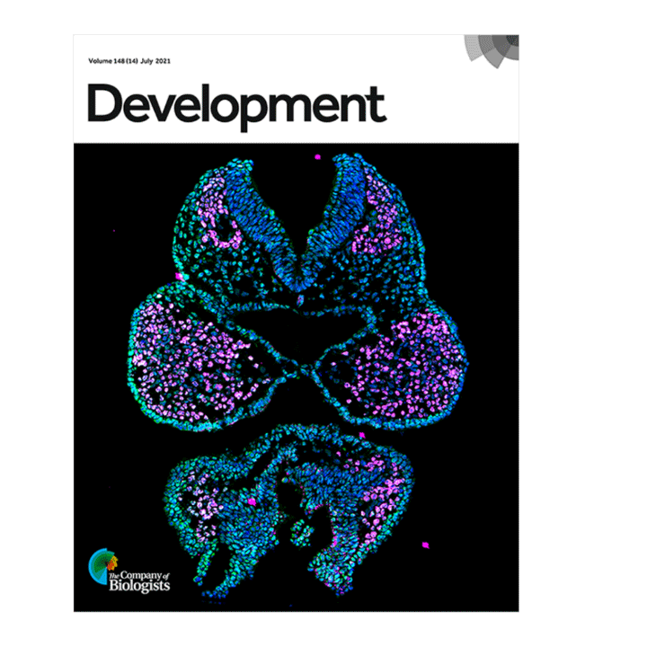 Dr. Brenna Dennison and Fantauzzo's recent work was published in Development. Their image of the cranial neural folds and first pharyngeal arches of a mouse embryo, acquired with a ZEISS Axio Observer 7 microscope with Apotome, was featured on the journal cover.