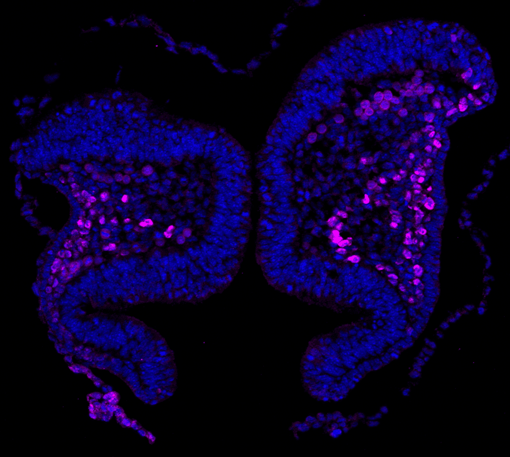 Sox10-positive neural crest cells (magenta) as detected by immunofluorescence staining of a section of cranial neural folds from an E8.0 mouse embryo. Nuclei were stained with DAPI (blue). Imaged with ZEISS Axio Observer 7 with Apotome.