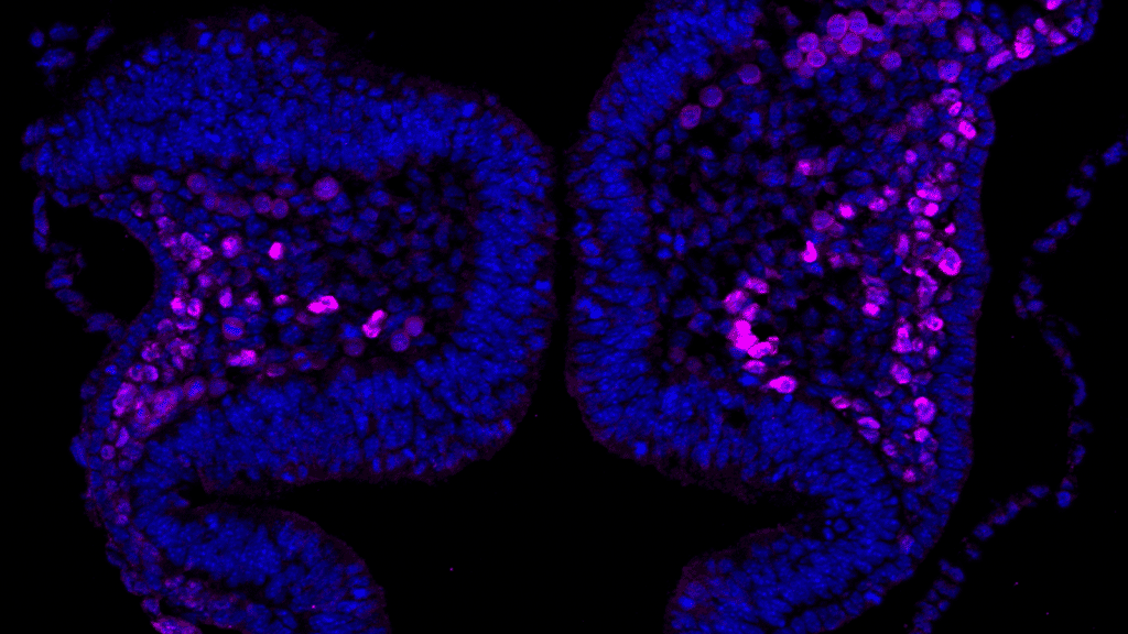 Sox10-positive neural crest cells (magenta) as detected by immunofluorescence staining of a section of cranial neural folds from an E8.0 mouse embryo. Nuclei were stained with DAPI (blue). Imaged with ZEISS Axio Observer 7 with Apotome.