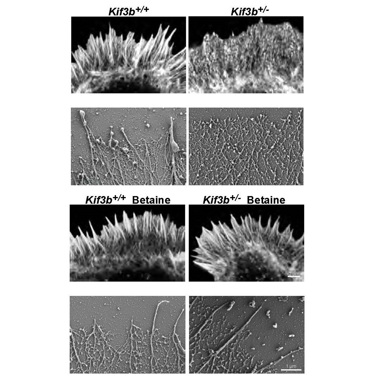 Imaging of actin cytoskeleton in the lamellipodia of primary hippocampal neurons of the indicated conditions at DIV1 (day 1 in vitro) either by Airyscan superresolution microscopy labelled with fluorescent phalloidin or by scanning electron microscopy. Scale bars, 2 μm (confocal microscopy) and 1 μm (electron microscopy).