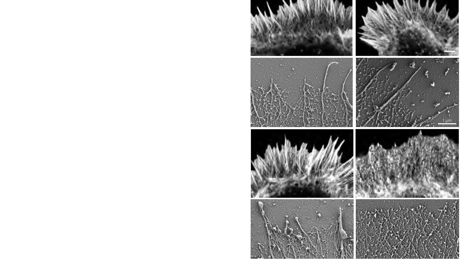 Imaging the Cytoskeleton to Understand Schizophrenia