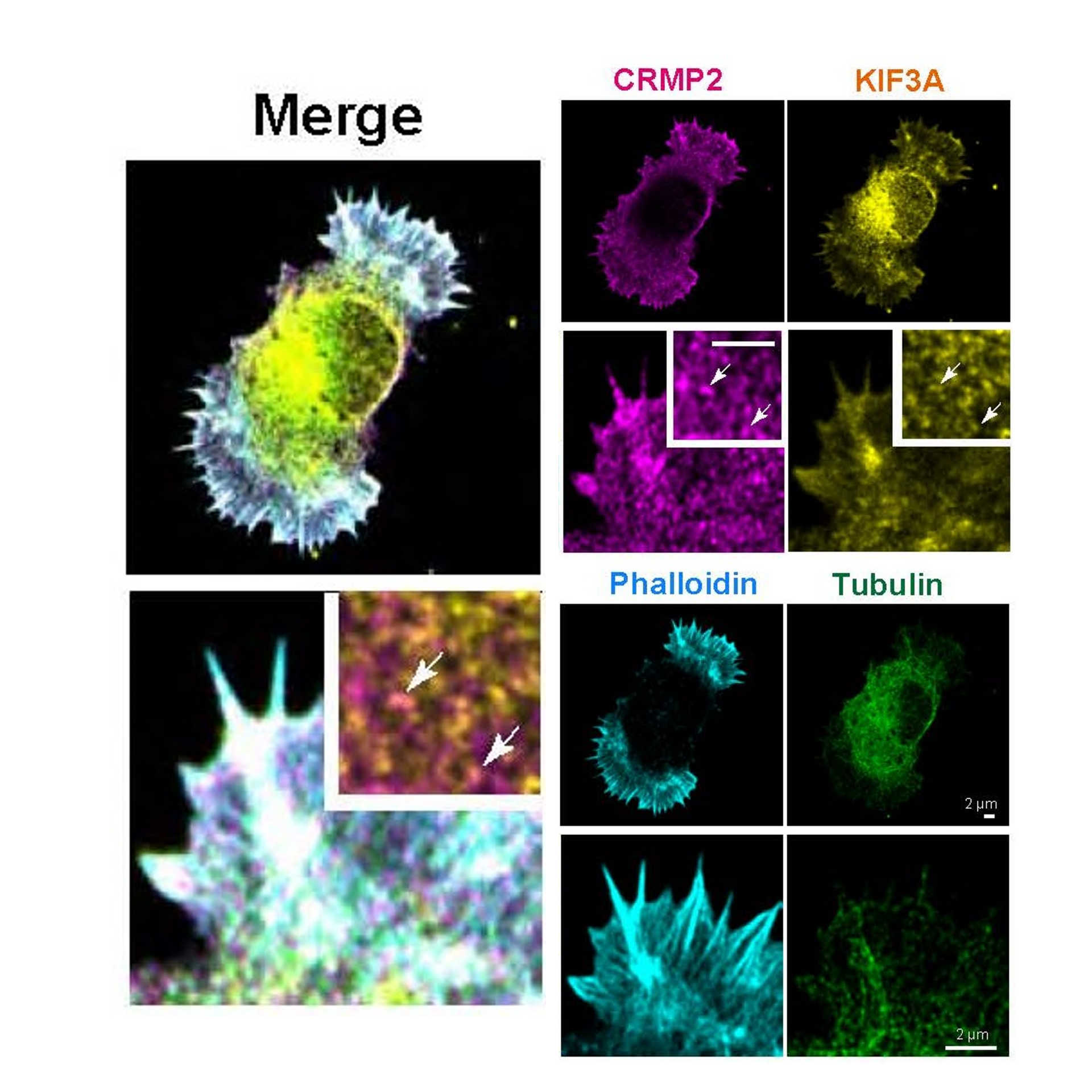 Kif3b+/+ primary hippocampal neuron at DIV1 (day 1 in vitro) labeled with an antibody against CRMP2 (magenta), an antibody against KIF3A (yellow), fluorescent phalloidin (cyan), and an antibody against α-tubulin (green). Imaged with confocal microscopy with Airyscan.