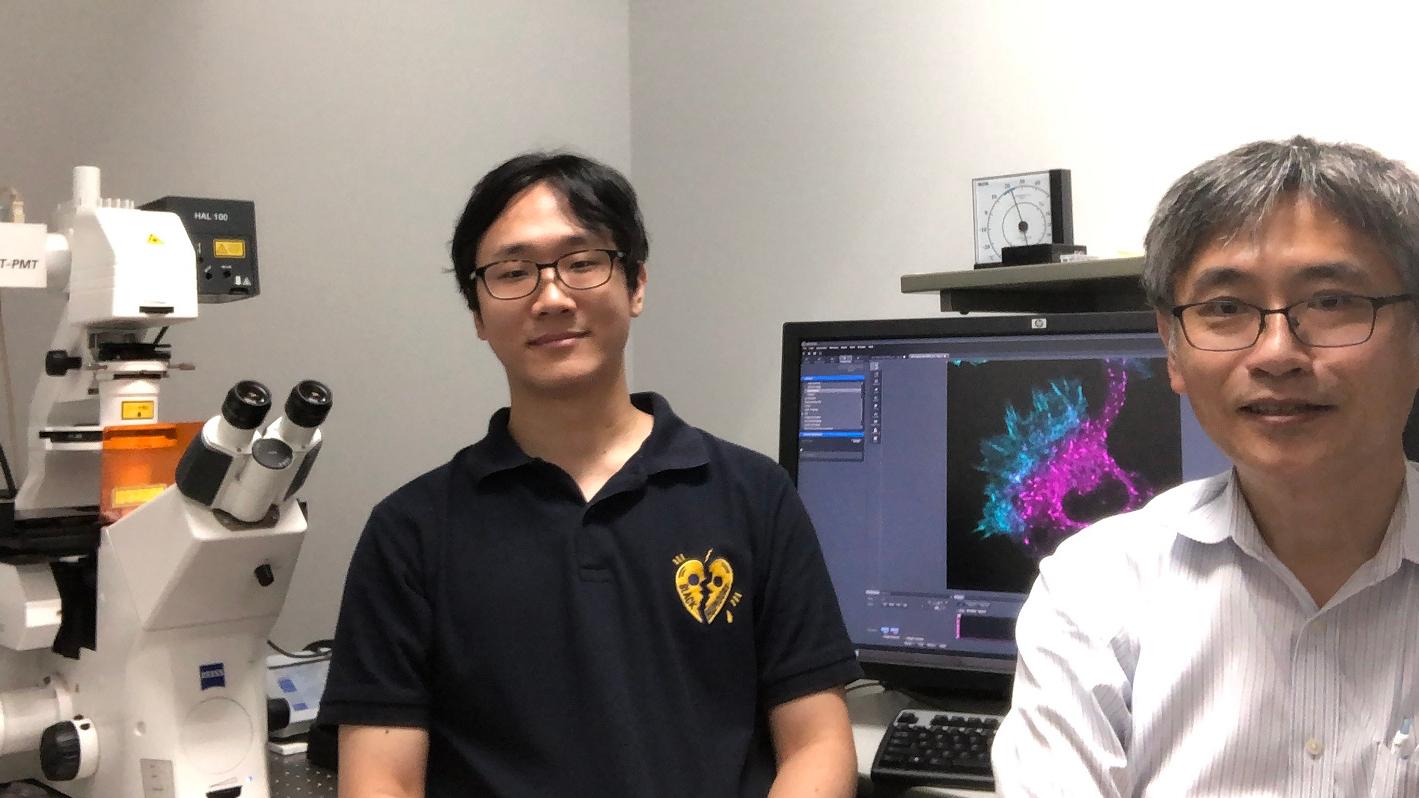 Imaging the Cytoskeleton to Understand Schizophrenia