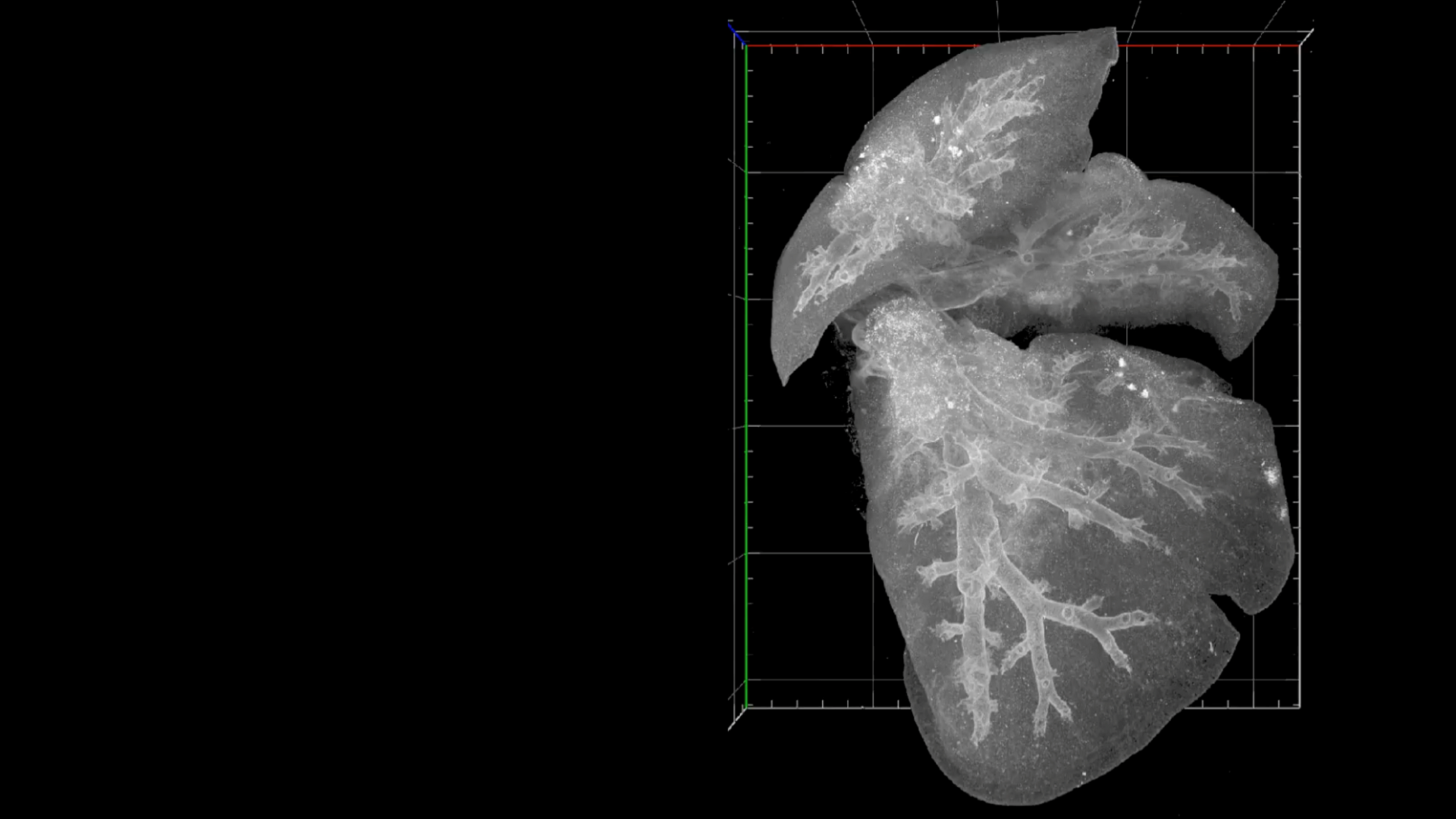 Imaging the Developing Lung to Explore a Critical Disease in Preterm Babies