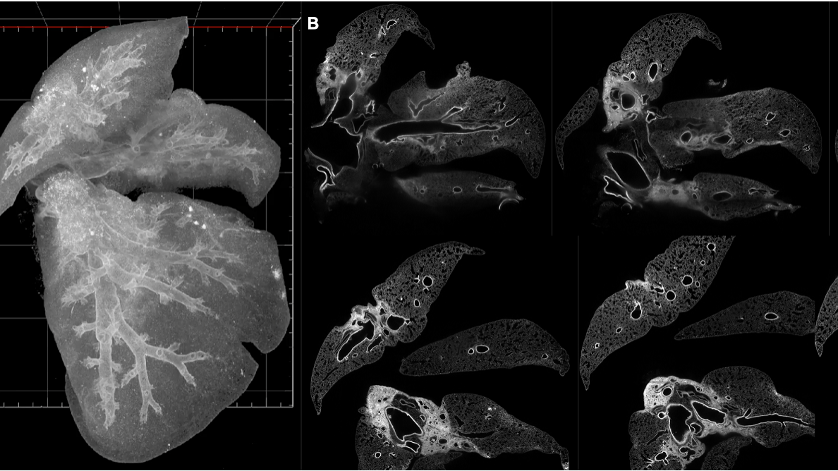 Imaging the Developing Lung to Explore a Critical Disease in Preterm Babies