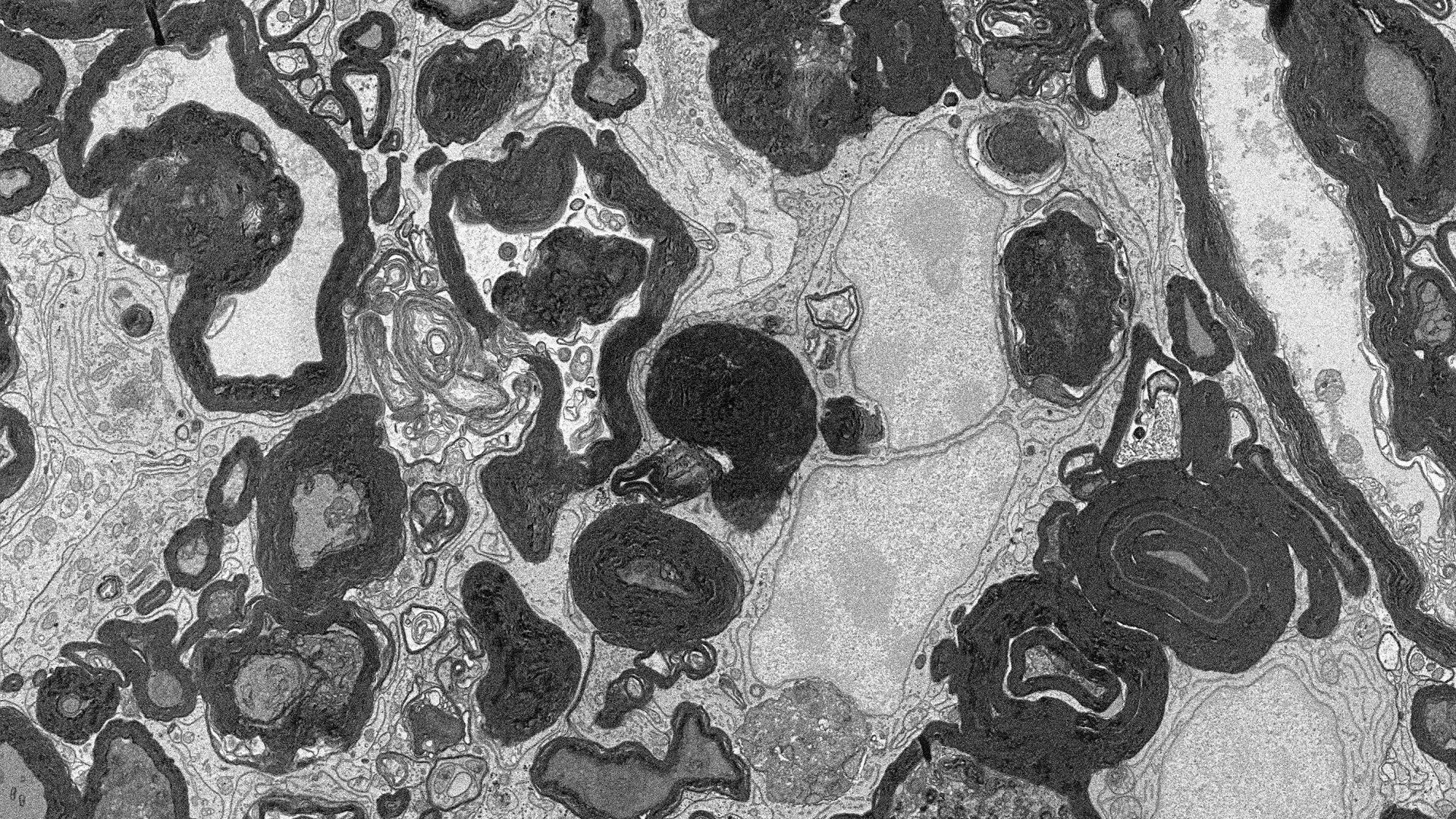 Microglia cells acquired with scanning electron microscopy