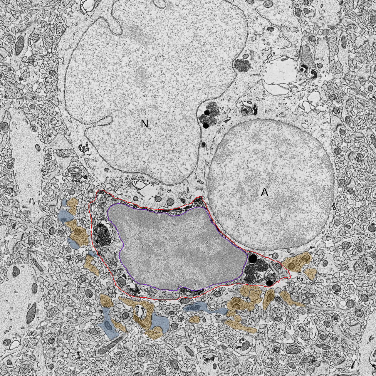 Scanning electron microscopy chip mapping image of a microglia 